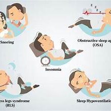 Management of sleeping disorder Management of sleeping disorder