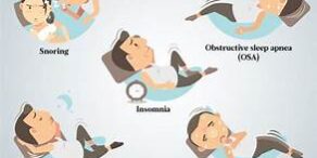 Management of sleeping disorder