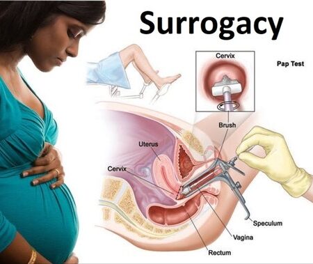 surrogacy