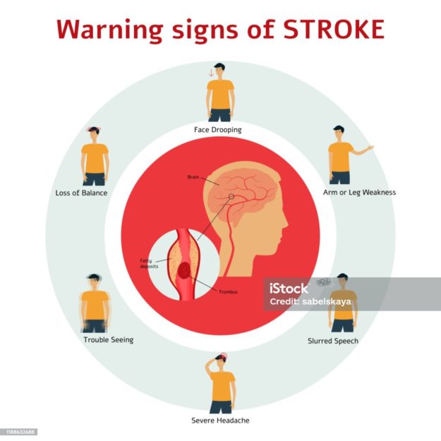 Stroke is an avoidable disease.
