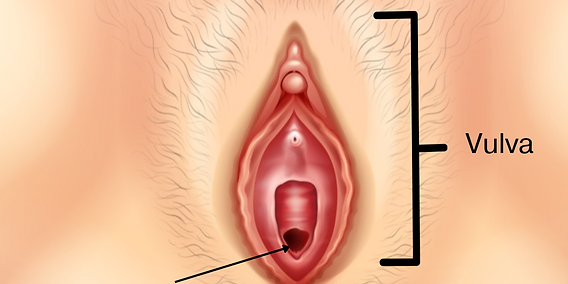 46a390_399c2314a4a74e838db7b17d3040bda5~mv2 Vaginismus