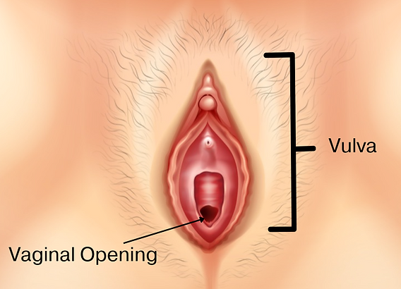 Vaginismus