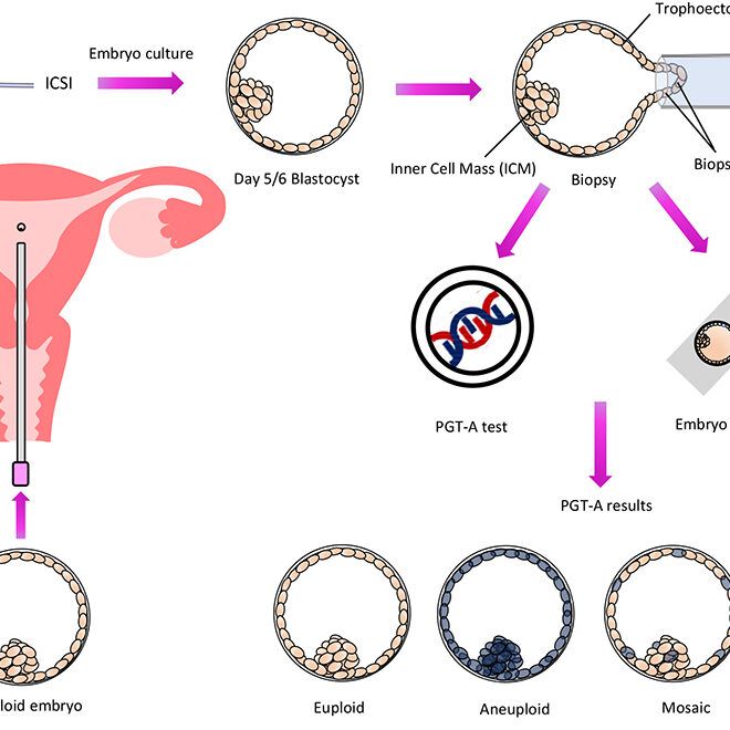 A Day in the Life of an IVF Cycle