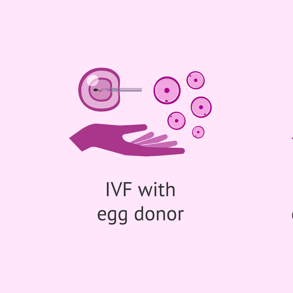 Using Donor Eggs or Sperm