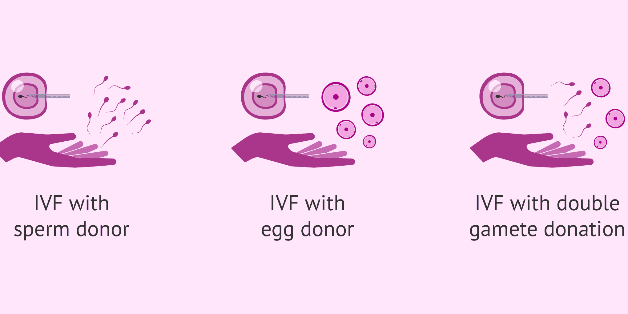 Using Donor Eggs or Sperm