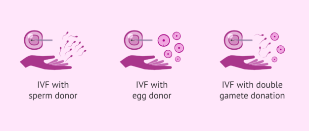 Using Donor Eggs or Sperm