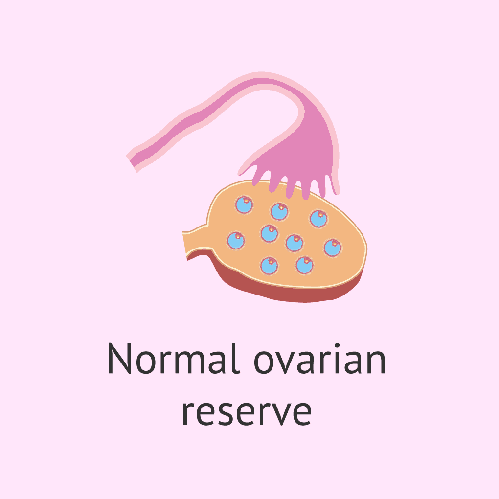 Understanding Diminished Ovarian Reserve