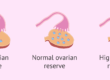Understanding Diminished Ovarian Reserve