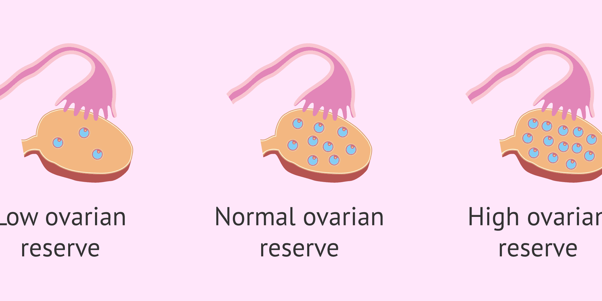 Understanding Diminished Ovarian Reserve