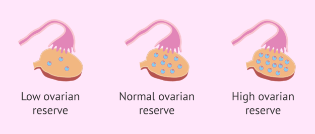 Understanding Diminished Ovarian Reserve