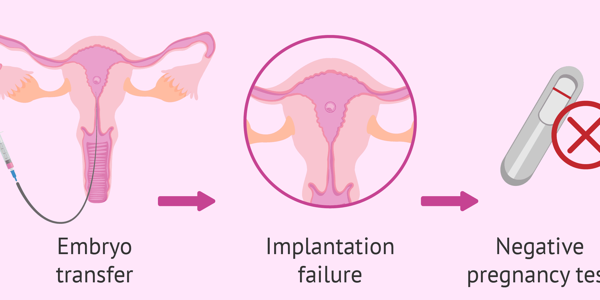 Understanding Repeated Implantation Failure