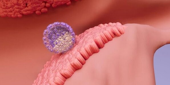 The Endometrium-Embryo Dialogue-5 The Endometrium–Embryo Dialogue