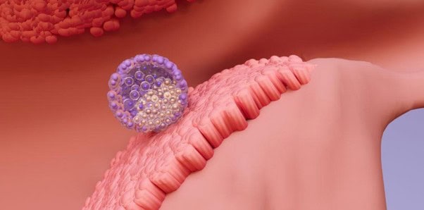 The Endometrium-Embryo Dialogue-5 The Endometrium–Embryo Dialogue
